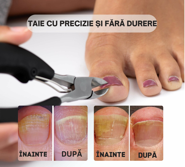 Tăietor de unghii ergonomic pentru femei